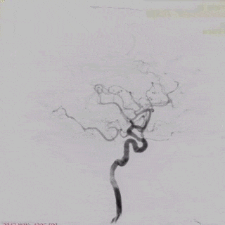 ppt21-3.gif