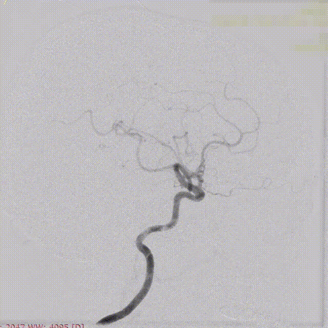 ppt3-3 00_00_00-00_00_30.gif