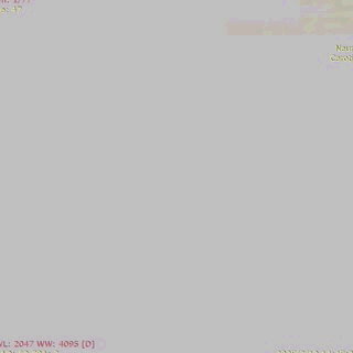 ppt43-2.gif