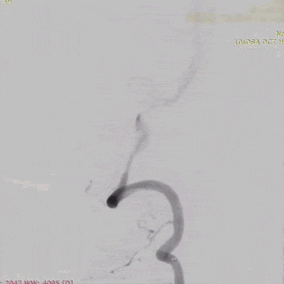 ppt44-1.gif