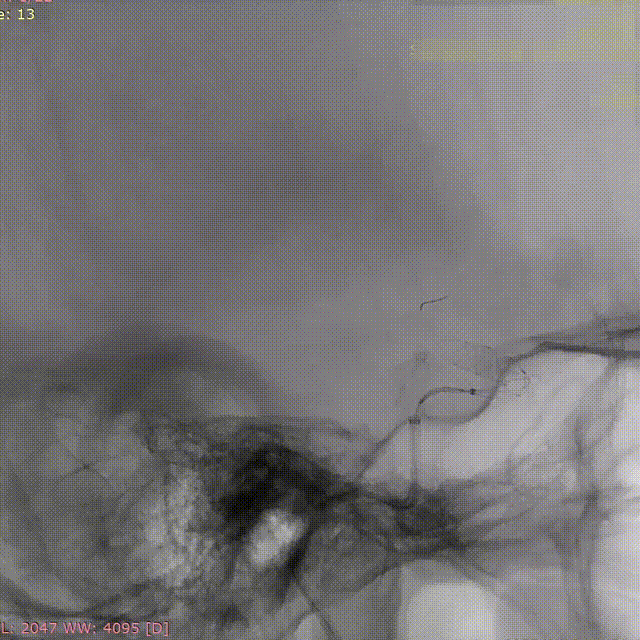 ppt12-2 00_00_00-00_00_30.gif