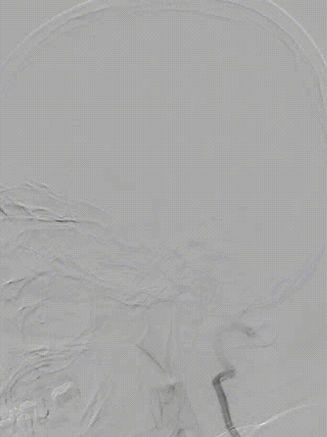 media4 00_00_00-00_00_30.gif