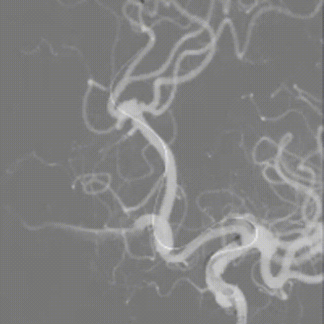 media4 00_00_00-00_00_30.gif