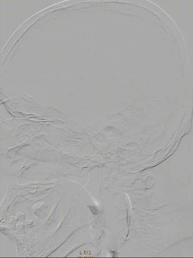 media7 00_00_00-00_00_30.gif