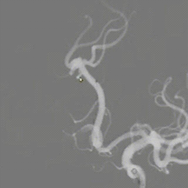 media3 00_00_00-00_00_30.gif