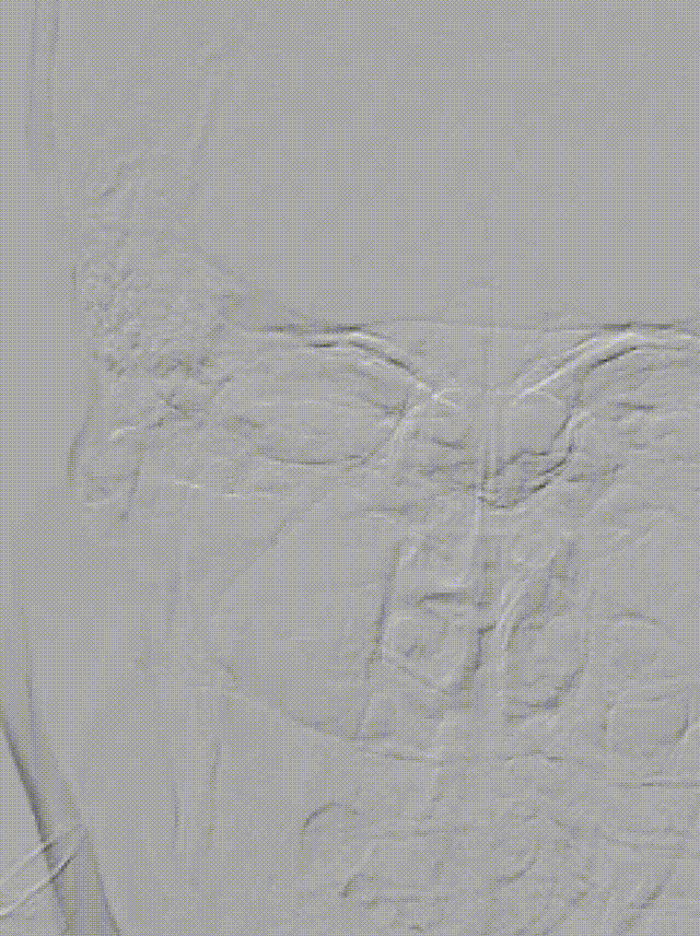 视频1-1 00_00_00-00_00_30.gif
