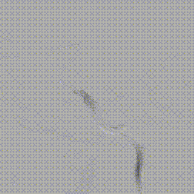 media12 00_00_00-00_00_30.gif