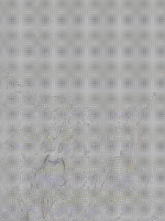 media6 00_00_00-00_00_30.gif