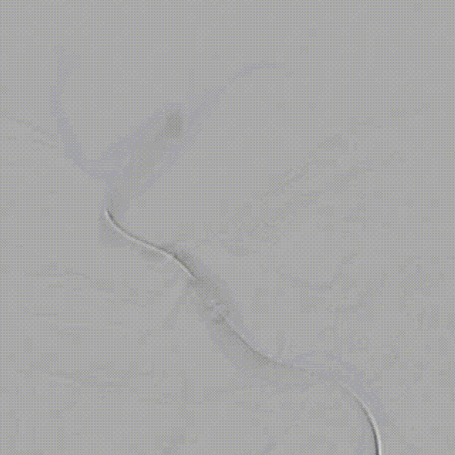 media16 00_00_00-00_00_30.gif