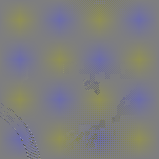 5、术后造影 00_00_00-00_00_30.gif