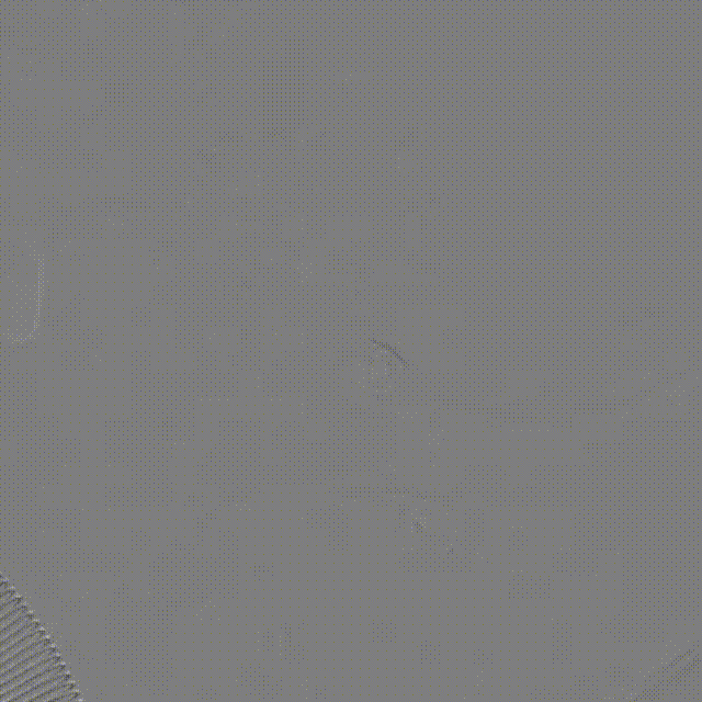 3、弹簧圈栓塞 00_00_00-00_00_30.gif