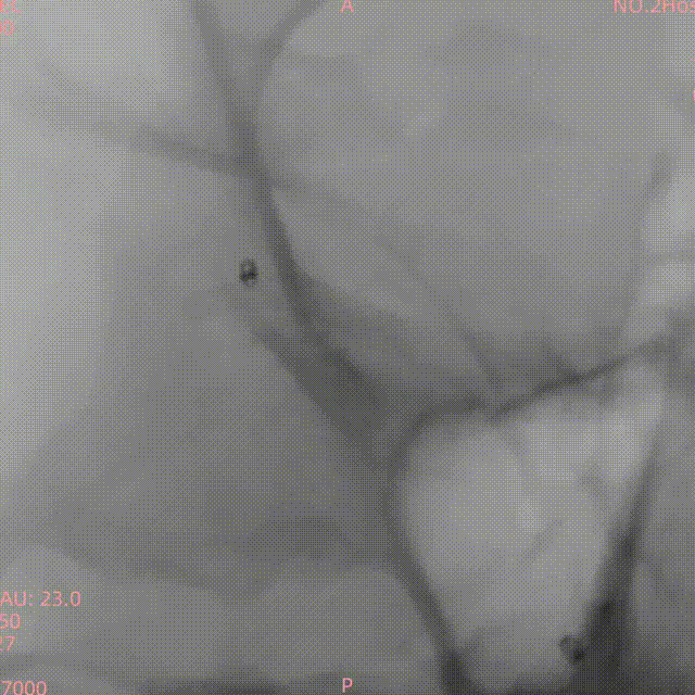 media7 00_00_00-00_00_30.gif