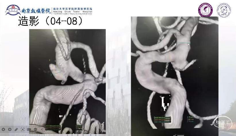 image11.png