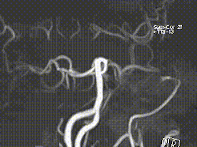视频3 00_00_00-00_00_30.gif