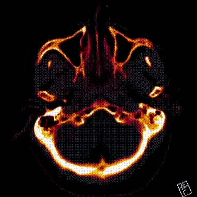 视频27 00_00_00-00_00_30.gif