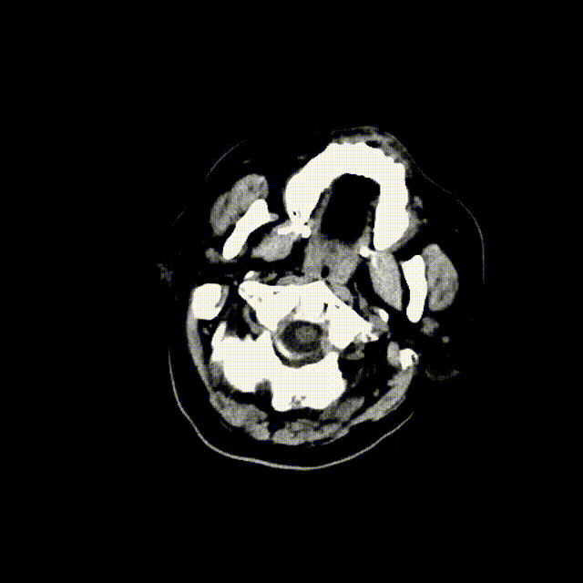 视频28 00_00_00-00_00_30.gif