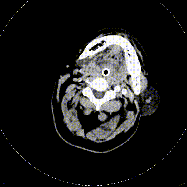 视频26 00_00_00-00_00_30.gif
