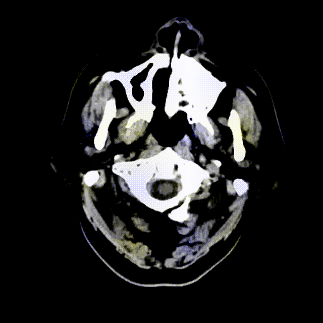 视频1 00_00_00-00_00_30.gif