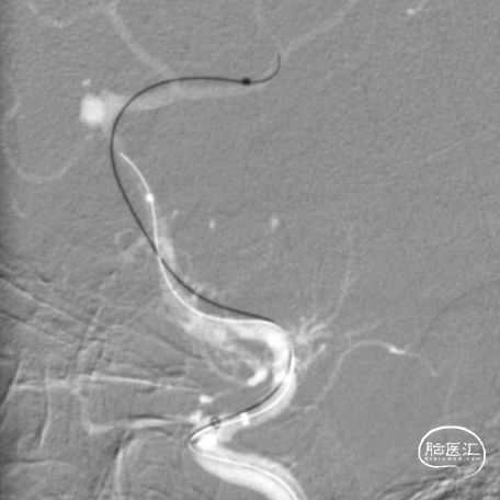 image15.GIF