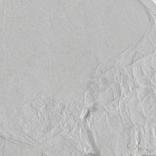 media2 00_00_00-00_00_30.gif