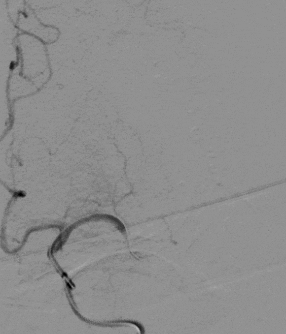 image16.GIF