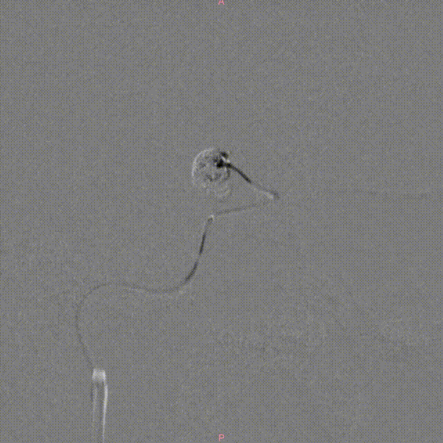 media6 00_00_00-00_00_30.gif