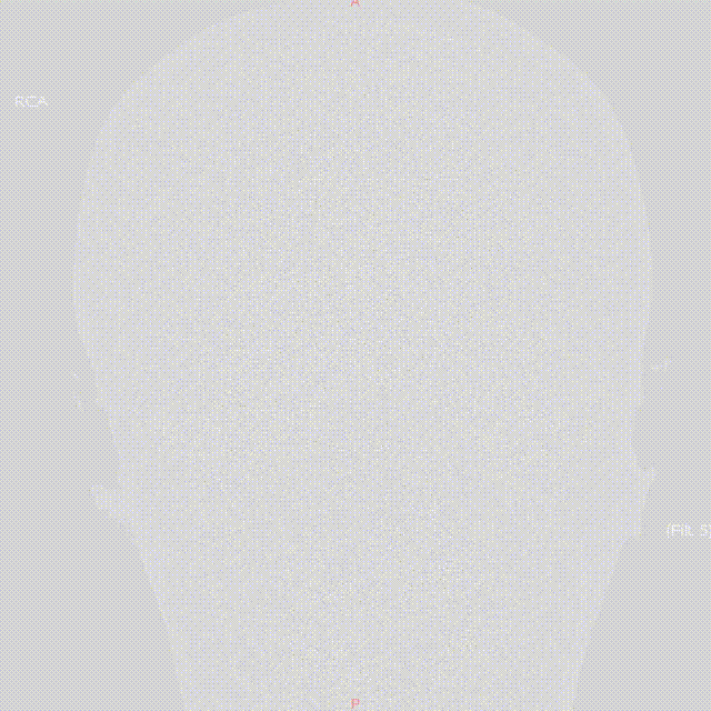 media2 00_00_00-00_00_30.gif