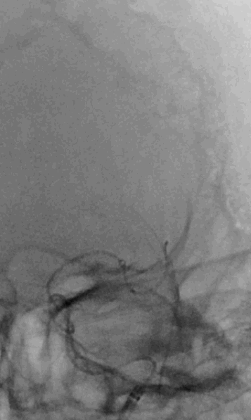 image14.GIF