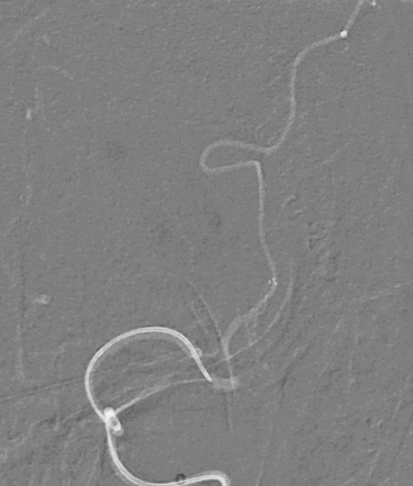 image17.GIF
