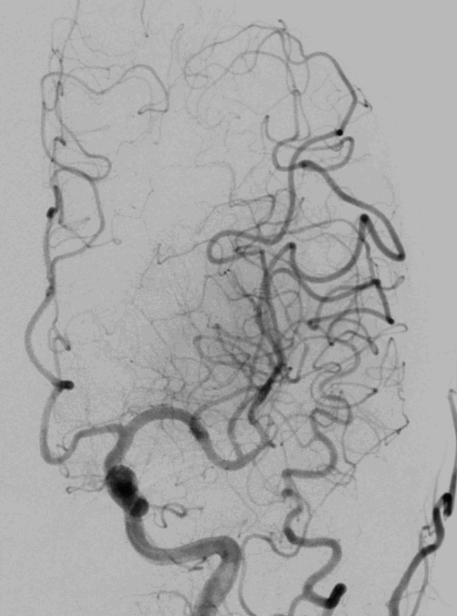 image18.GIF