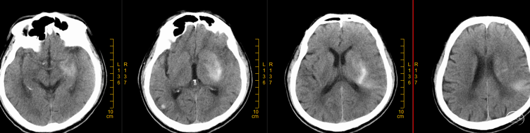 image22.png