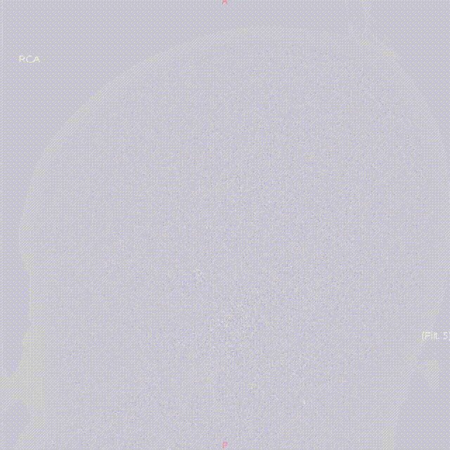media12 00_00_00-00_00_30.gif