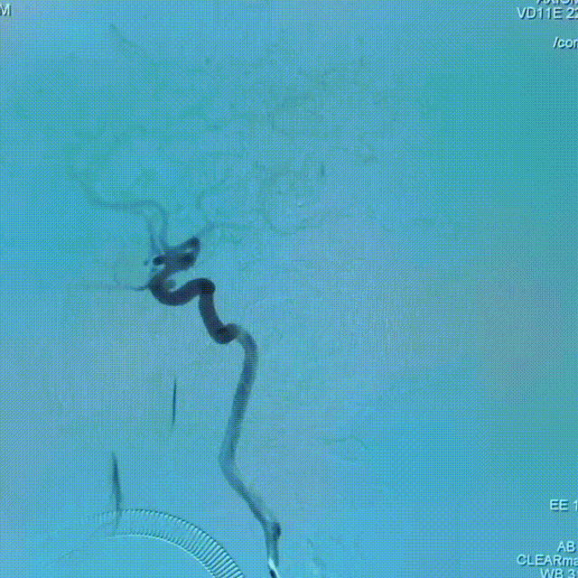 media2 00_00_00-00_00_30.gif