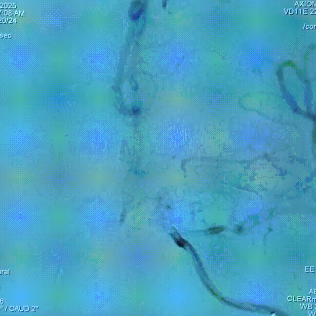 media13 00_00_00-00_00_30.gif