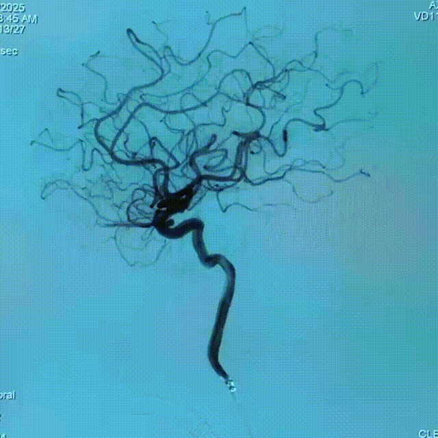 media16 00_00_00-00_00_30.gif