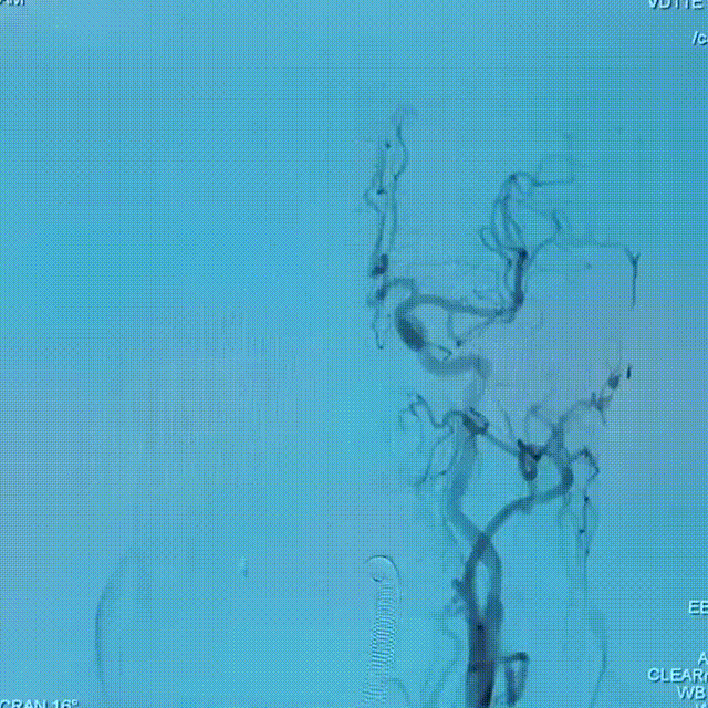 media1 00_00_00-00_00_30.gif