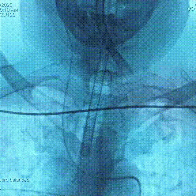 media5 00_00_00-00_00_30.gif