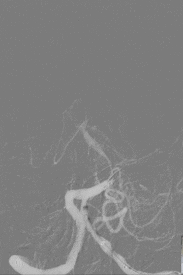2.gif