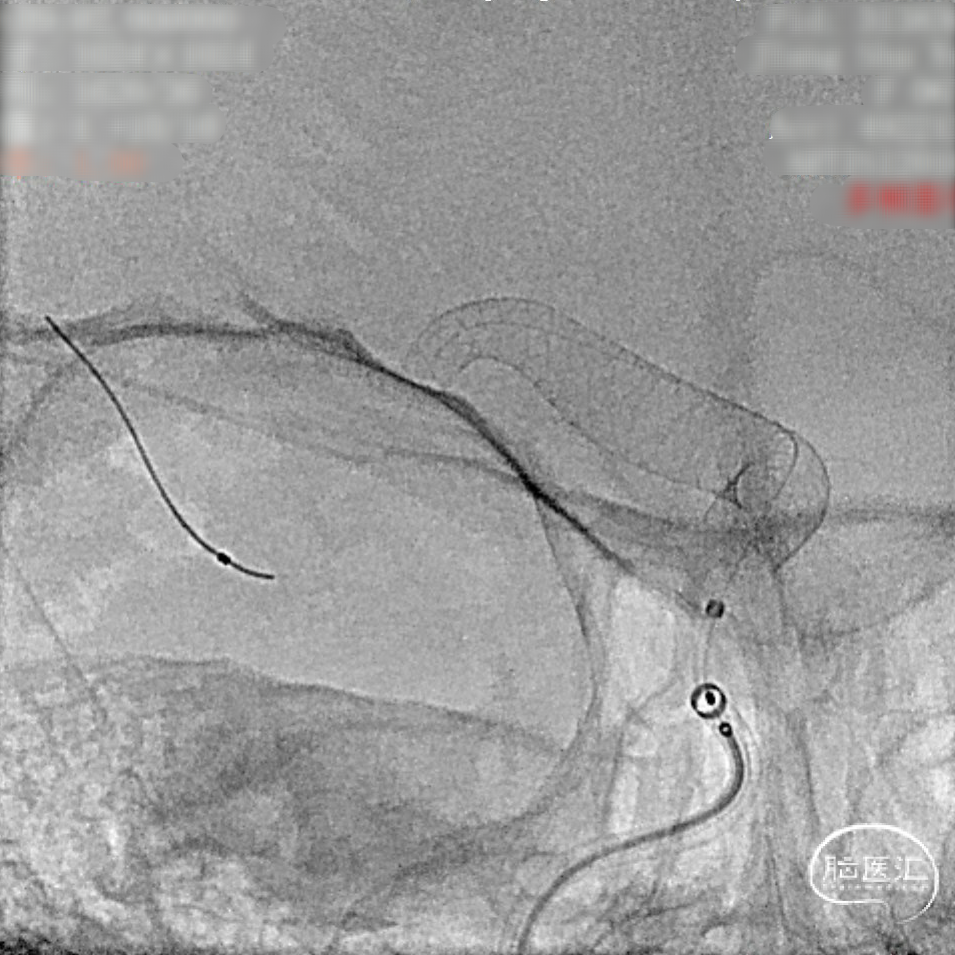 image22.png
