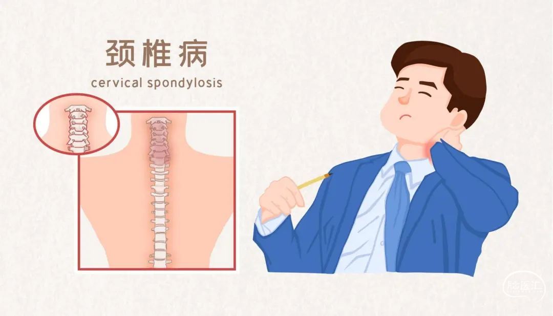 颈椎病是这样形成的，预防的方法一定要了解 - 病症知识 - 轻壹