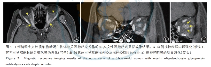 图3.png