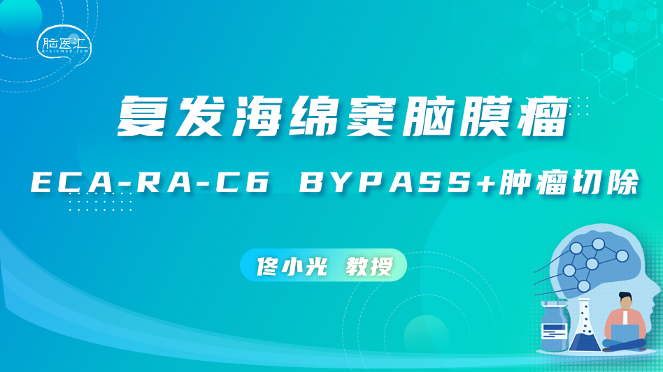 佟小光教授：复发海绵窦脑膜瘤 ECA-RA-C6 bypass+肿瘤切除
