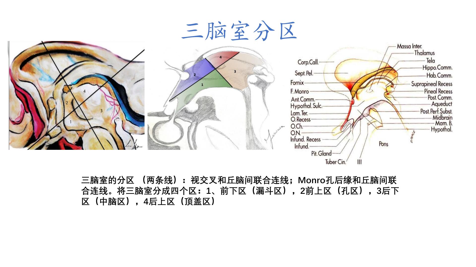 神经内镜下经鼻扩大入路三脑室的相关解剖学探讨 - 脑医汇