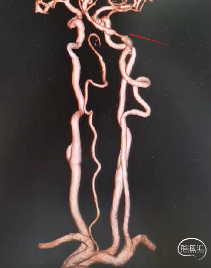 640 (2).png
