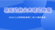 基底动脉尖动脉瘤辅助栓塞