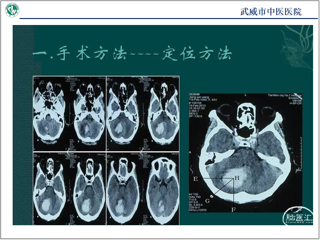 微信截图_20221122115613.png