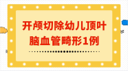 广州医科大学附属第五医院 病例分享：开颅切除幼儿顶叶脑血管畸形1例