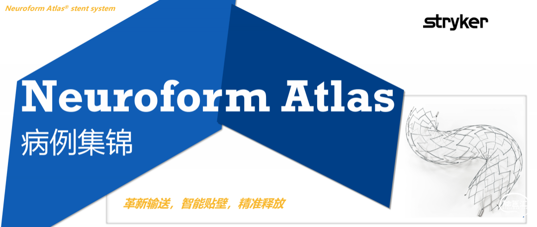 Atlas病例集丨汪晶：“智能贴壁，微管自由”—Atlas支架辅助栓塞路径迂曲 