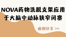 3例NOVA药物洗脱支架应用于大脑中动脉狭窄闭塞病例分享