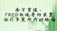 中枢介入第392期：南方首植：FRED血流导向装置治疗多发颅内动脉瘤
